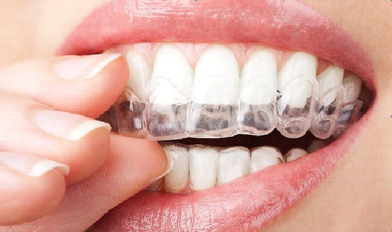 Edmonton Orthodontist Dedicated to Healthy Smiles and Facial Balance